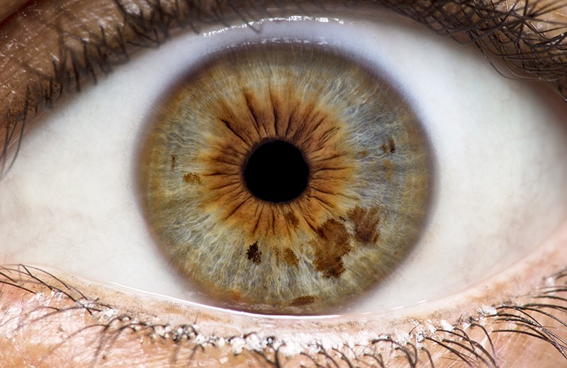 Common Myths And Misconceptions About Iridology